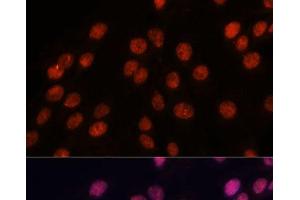 Immunofluorescence analysis of C6 cells using IPO8 Polyclonal Antibody at dilution of 1:100. (Importin 8 antibody)