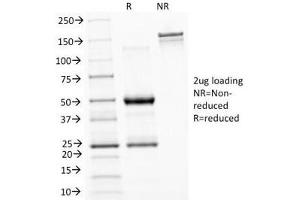 SDS-PAGE Analysis of Purified, BSA-Free ASRGL1 Antibody (clone CRASH/1289). (ASRGL1 antibody)