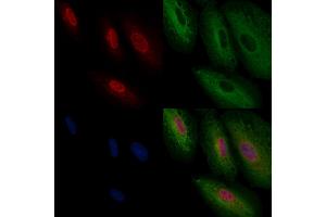 ABIN6257778 and ABIN6274220 staining  cells by IF/ICC.
