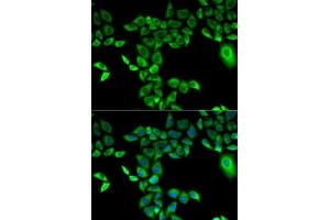 Immunofluorescence analysis of A-549 cells using FMO3 antibody (ABIN3015685, ABIN3015686, ABIN3015687 and ABIN6219039). (FMO3 antibody  (AA 263-532))