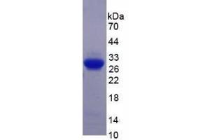 SDS-PAGE analysis of Human Semaphorin 5B Protein. (SEMA5B Protein)