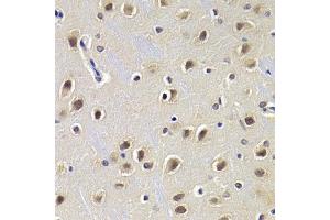 Immunohistochemistry of paraffin-embedded rat brain using CDKN1B Antibody. (CDKN1B antibody)