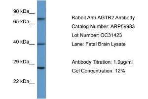 Western Blotting (WB) image for anti-Angiotensin II Receptor, Type 2 (AGTR2) (N-Term) antibody (ABIN2788290) (Angiotensin II Type 2 Receptor antibody  (N-Term))