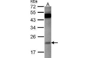 WB Image Sample (30 ug of whole cell lysate) A: HCT116 12% SDS PAGE antibody diluted at 1:500 (RAP1B antibody)