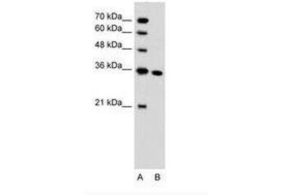 SLC25A29 antibody  (C-Term)