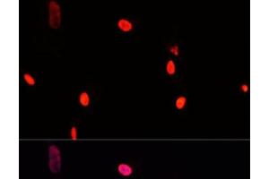 Immunofluorescence analysis of A431 cells using GTF2I Polyclonal Antibody at dilution of 1:100. (GTF2I antibody)