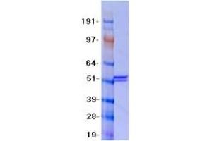Western Blotting (WB) image for Malonyl CoA Decarboxylase (MLYCD) protein (Myc-DYKDDDDK Tag) (ABIN2726112)
