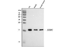 Western blot analysis of U1-C/SNRPC using anti-U1-C/SNRPC antibody (ABIN7599016). (SNRPC antibody  (AA 1-159))
