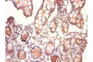 Immunohistochemistry of paraffin-embedded human small intestine tissue using ABIN7148869 at dilution of 1:100 (CDK2AP1 antibody  (AA 1-115))
