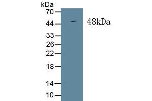 Detection of Recombinant ISLR, Human using Monoclonal Antibody to Immunoglobulin Superfamily Containing Leucine Rich Repeat Protein (ISLR) (ISLR antibody  (AA 19-428))