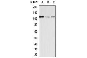 Western blot analysis of Desmoglein 4 expression in HEK293T (A), SP2/0 (B), H9C2 (C) whole cell lysates. (Desmoglein 4 antibody  (Center))