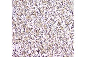 IHC analysis of LCP1 using anti-LCP1 antibody (ABIN6719421). (LCP1 antibody)