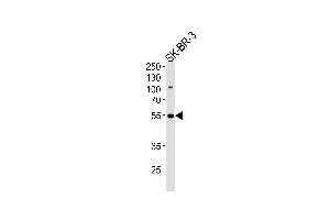 Western blot analysis of lysate from SK-BR-3 cell line, using SMARCE1 Antibody at 1:1000 at each lane. (SMARCE1 antibody  (C-Term))