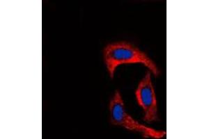 Immunofluorescent analysis of MMP1 staining in MCF7 cells.