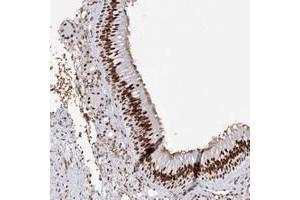 Immunohistochemical staining of human nasopharynx with ZNF638 polyclonal antibody  shows strong nuclear positivity in respiratory epithelial cells.