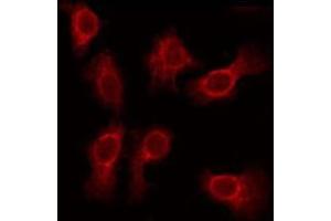 ABIN6275615 staining Hela by IF/ICC. (SVOP antibody  (Internal Region))