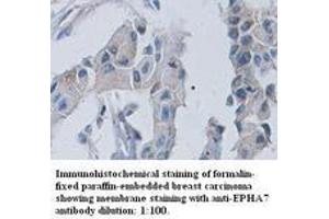 Image no. 1 for anti-EPH Receptor A7 (EPHA7) (C-Term) antibody (ABIN791047) (EPH Receptor A7 antibody  (C-Term))