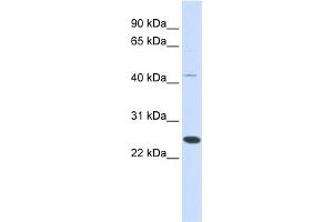 WB Suggested Anti-FAM119A Antibody Titration: 0. (FAM119A antibody  (Middle Region))