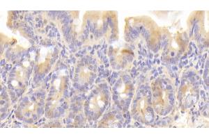 Detection of CYPA in Mouse Small intestine Tissue using Polyclonal Antibody to Cyclophilin A (CYPA) (PPIA antibody  (AA 2-164))