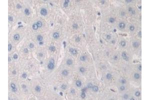 Detection of PKD2 in Human Liver Tissue using Polyclonal Antibody to Protein Kinase D2 (PKD2) (PKD2 antibody  (AA 621-832))