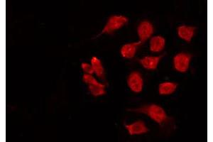 ABIN6269043 staining HeLa by IF/ICC. (CHEK1 antibody  (Internal Region))