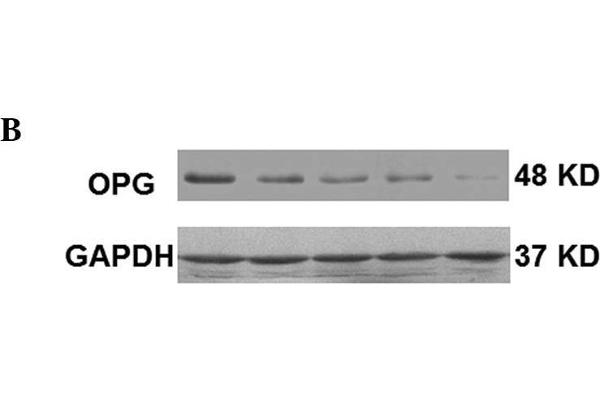 RANKL antibody  (AA 221-300)