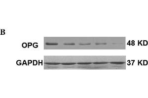 Levels of OPG in third-generation osteoblasts following treatment with different doses of r-Mt cpn10 for 8 h. (RANKL antibody  (AA 221-300))
