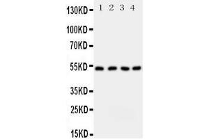 Western Blotting (WB) image for anti-serine Palmitoyltransferase, Long Chain Base Subunit 1 (SPTLC1) (AA 138-154), (Middle Region) antibody (ABIN3043056)