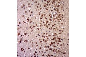 Paraformaldehyde-fixed, paraffin embedded rat brain, Antigen retrieval by boiling in sodium citrate buffer (pH6. (UBA1 antibody  (AA 961-1058))