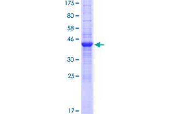 SLX1A/GIYD2 Protein (AA 1-161) (GST tag)