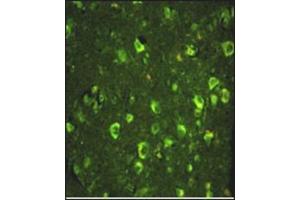 Immunofluorescence analysis of ABI1 Antibody (N-term) with paraffin-embedded human brain tissue. (ABI1 antibody  (N-Term))