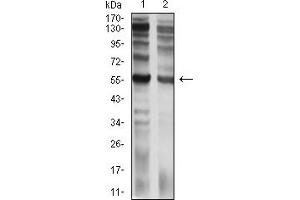 Western blot analysis using CD129 mouse mAb against C6 (1) and PC-3 (2) cell lysate. (IL9 Receptor antibody  (AA 41-270))