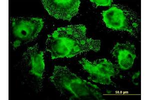 Immunofluorescence of monoclonal antibody to MRPL12 on HeLa cell.