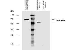 Western blotting analysis of human serum albumin using mouse monoclonal antibody AL-01 on human plasma and lysate of HeLa cell line (albumin non-expressing cell line, negative control) under non-reducing and reducing conditions. (Albumin antibody  (Biotin))