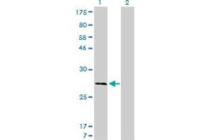 Western Blot analysis of CAPNS1 expression in transfected 293T cell line by CAPNS1 monoclonal antibody (M01), clone 3C4. (Calpain S1 antibody  (AA 172-260))