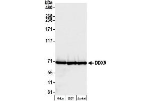 Western Blotting (WB) image for anti-DEAD (Asp-Glu-Ala-Asp) Box Polypeptide 5 (DDX5) (C-Term) antibody (ABIN7454642)