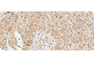 PHF6 antibody