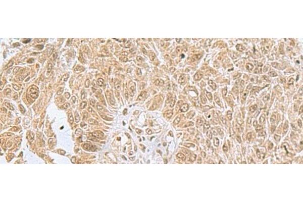 PHF6 antibody