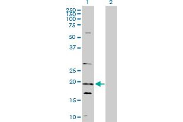 NUDT10 抗体  (AA 1-164)