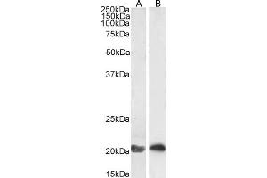Immunohistochemistry (IHC) image for anti-GTPase NRas (NRAS) (Internal Region) antibody (ABIN302138)