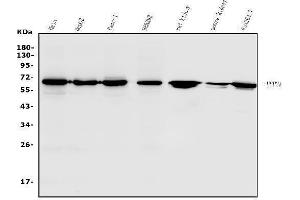 Western blot analysis of USP21 using anti-USP21 antibody (ABIN7601053).