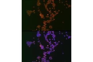 Immunofluorescence analysis of Jurkat cells using Ikaros Rabbit mAb (ABIN7267841) at dilution of 1:100 (40x lens). (IKZF1 antibody)