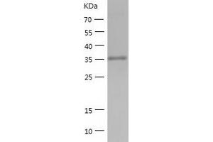 Western Blotting (WB) image for ADP-Ribosylarginine Hydrolase (ADPRH) (AA 1-357) protein (His tag) (ABIN7286493) (ADPRH Protein (AA 1-357) (His tag))