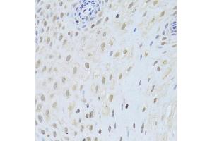 Immunohistochemistry of paraffin-embedded human esophagus using AIFM1 Antibody (ABIN5971393) at dilution of 1/200 (40x lens). (AIF antibody)