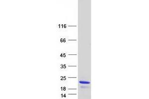 Chromosome 7 Open Reading Frame 53 (C7ORF53) (Transcript Variant 2) protein (Myc-DYKDDDDK Tag)