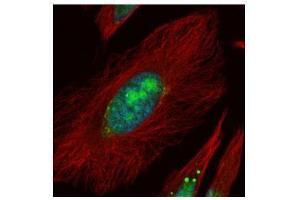 ICC/IF Image Confocal immunofluorescence analysis (Olympus FV10i) of paraformaldehyde-fixed HeLa, using UTP6, antibody (green) at 1:500 dilution. (UTP6 antibody  (Center))