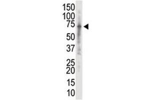 Western blot analysis of IRAK2 antibody and K562 cell lysate. (IRAK2 antibody  (AA 549-581))