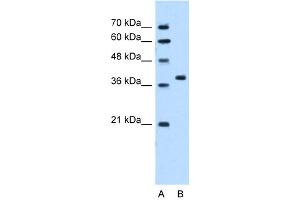 WB Suggested Anti-RUNDC2A Antibody Titration:  5. (SNX29 antibody  (N-Term))