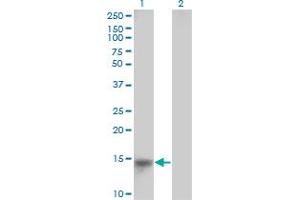 LRRC8D antibody  (AA 1-143)