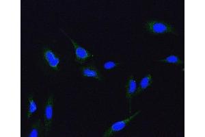 IF analysis of ME2 using anti-ME2 antibody (ABIN7600967). (NAD-ME antibody  (AA 26-584))